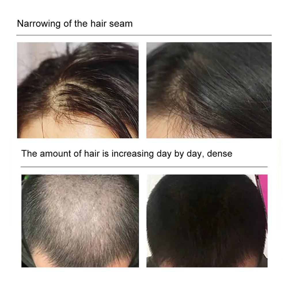 Huile Capillaire Essentielle pour une Croissance Rapide des Cheveux
