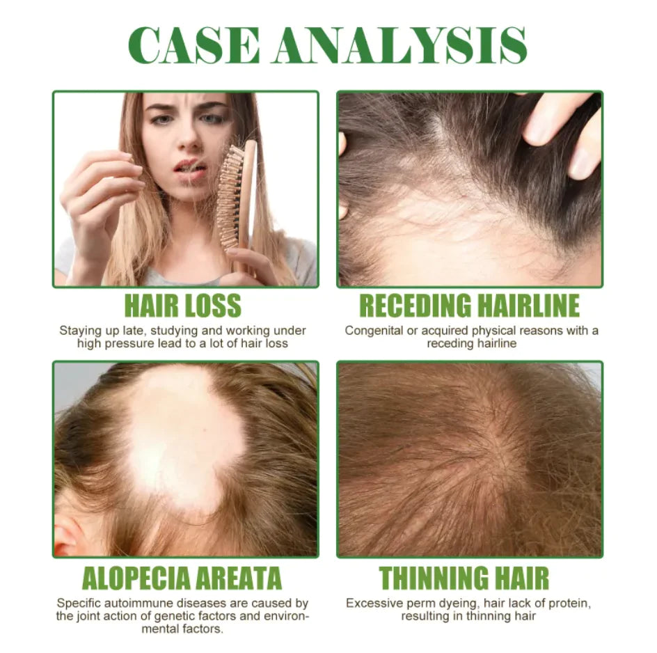 Huile Essentielle Réparatrice de Cheveux au Romarin